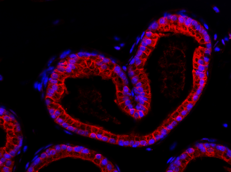 Zellzusammenschlüsse bilden die Grundlage für die Organentstehung. Manchmal bilden sich dabei interessante Formen aus, wie hier diese herzförmige Ansammlung von Prostatazellen.