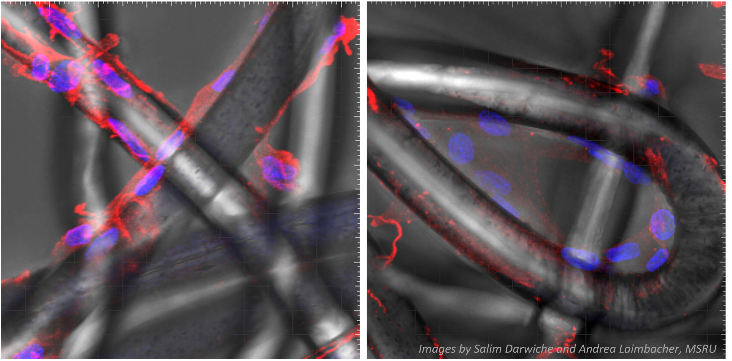 Cells extracted from a sheep’s nucleus pulposus tissue in a cervical intervertebral disc were expanded in culture and seeded on a polyethylene terephthalate scaffold. The fibers are shown above as well as the cell actin cytoskeleton in red and the cell nuclei in blue. The aim of this project is to tissue engineer intervertebral disc components and to implant these constructs for intervertebral disc replacement. Images taken by Salim Darwiche and Andrea Laimbacher, MSRU